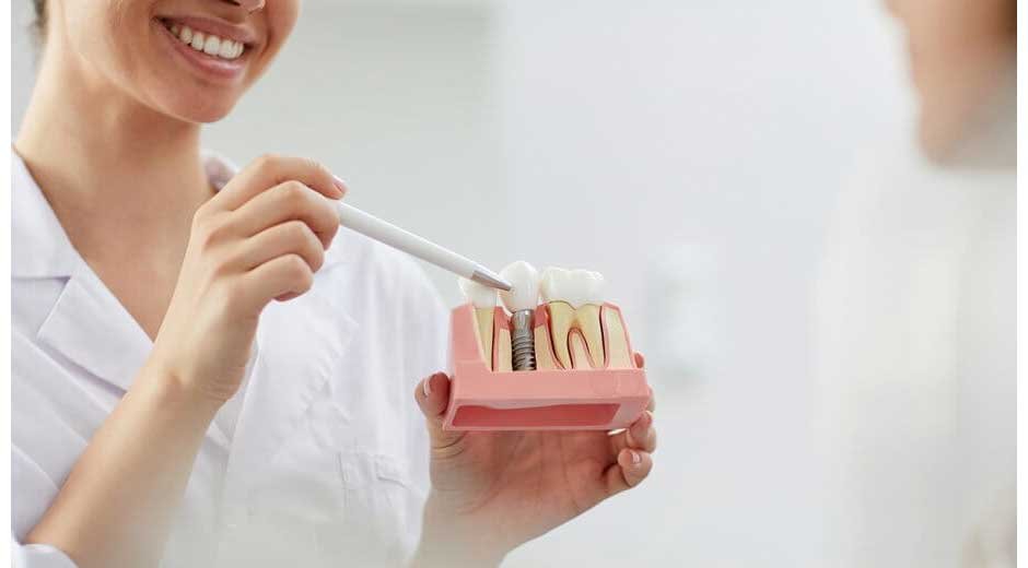 How Dental Implants Can Improve Your Smile