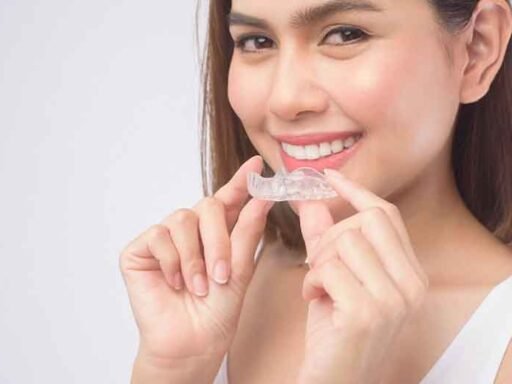 How Invisalign Aligners Are Customized To Fit Your Unique Smile