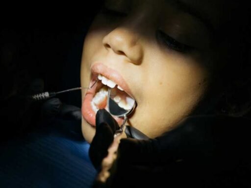 A-Complete-Guide-to-Restoring-Your-Smile-After-Tooth-Loss