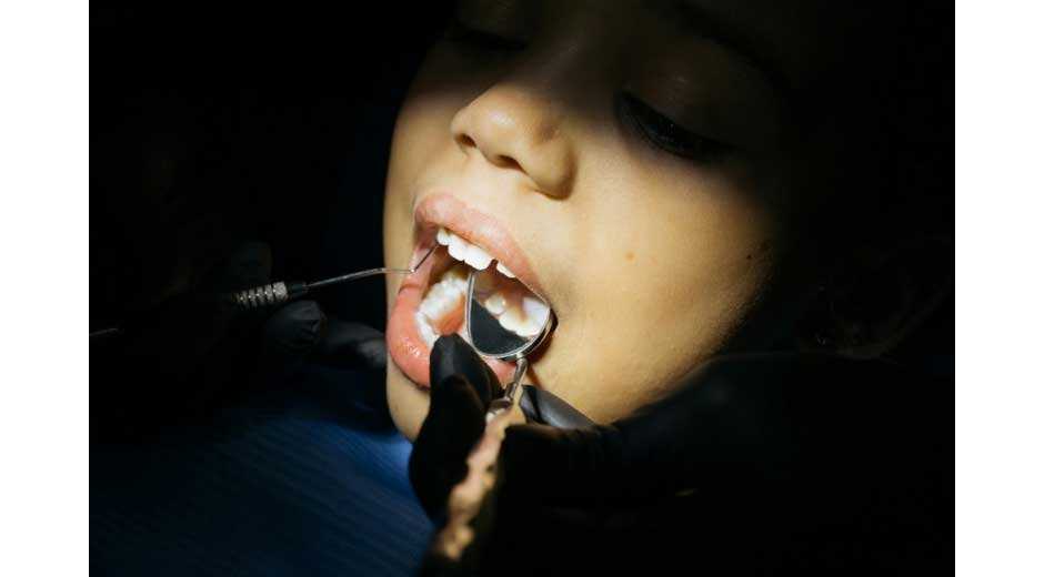 A-Complete-Guide-to-Restoring-Your-Smile-After-Tooth-Loss