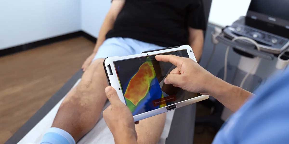Exploring Vein Treatment Technology
